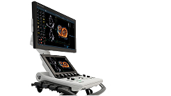 Vivid™ Cardiovascular Ultrasound