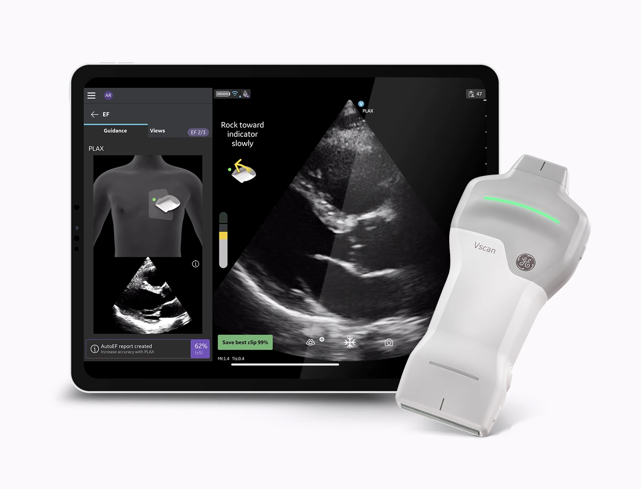 Vscan and iPad showing the scan image
