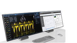 Post-processing and reporting solutions