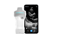 Vscan Air™ SL with Caption AI™