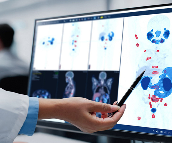 Hand of medical professional pointing at scan