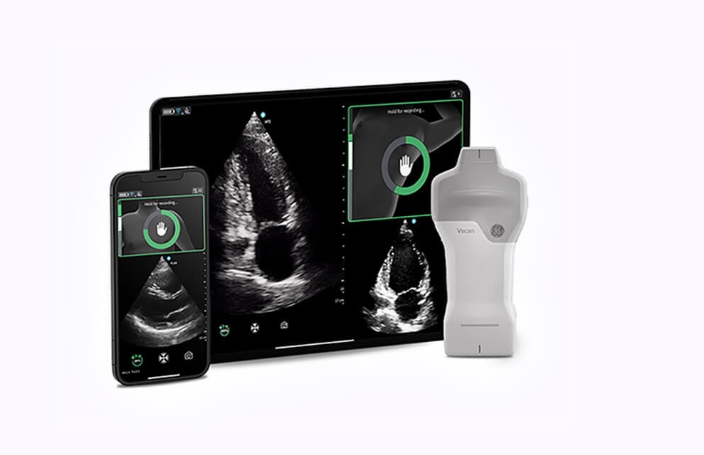 Vscan Air™ SL with Caption AI™