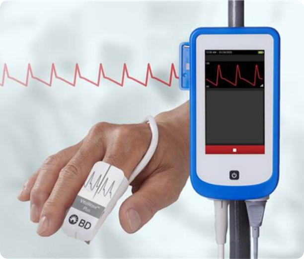 Hand-worn VitaWave™ Plus Cuff connected to a HemoSphere Stream™ displaying a red waveform for continuous patient monitoring.