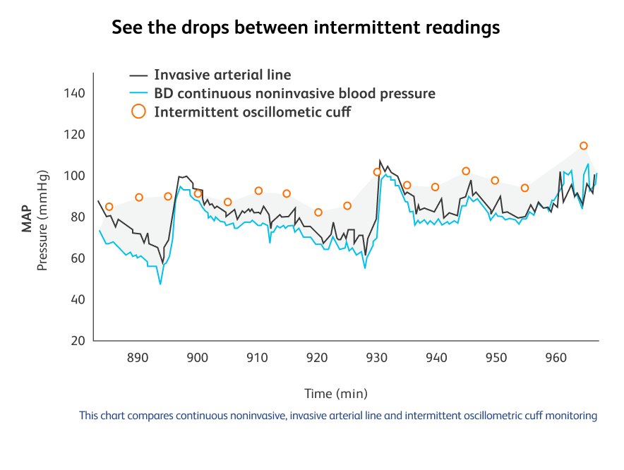 Graph of intermitted blood pressure readings vs continuous blood pressure reading.