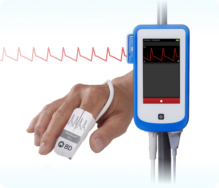 A person's hand with a VitaWave Plus finger sensor and a HemoSphere Stream™ displaying a red waveform, indicating vital sign monitoring.