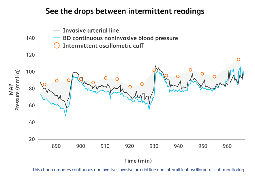 Graph of intermitted blood pressure readings vs continuous blood pressure reading.