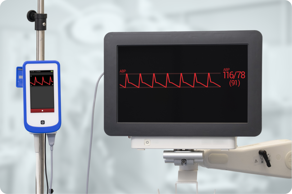 a HemoSphere Stream™ module connected to a compatible monitor.